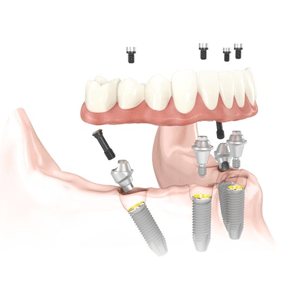 Dental in Baltimore