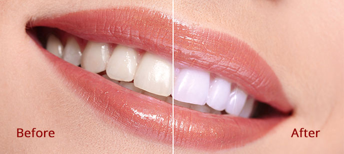 Cosmetic Dentistry Baltimore