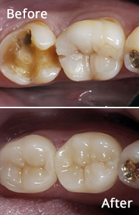 Cosmetic Dentistry in Maryland MD