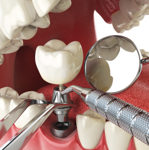 Dental in Baltimore