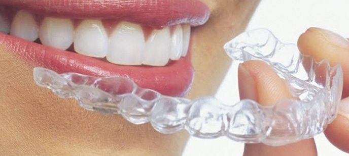 Invisalign in Baltimore