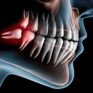 Best Dentist in Baltimore